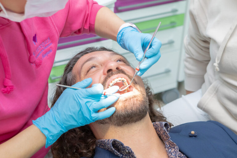 Studio Meneguzzi - ortodonzia intercettiva Studio Meneguzzi - ortodonzia intercettiva | apparecchio linguale